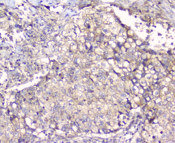 ALIX/PDCD6IP Rabbit Polyclonal Antibody