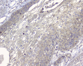 ALIX/PDCD6IP Rabbit Polyclonal Antibody