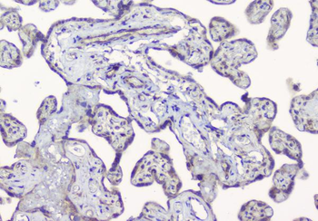 ALIX/PDCD6IP Rabbit Polyclonal Antibody
