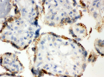 ERp57/PDIA3 Rabbit Polyclonal Antibody