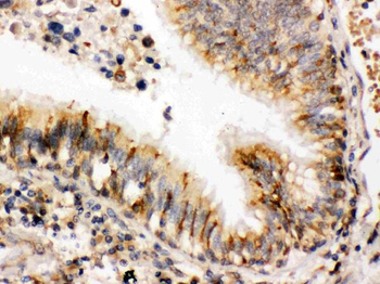ERp57/PDIA3 Rabbit Polyclonal Antibody