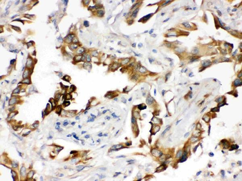 PGRMC1 Rabbit Polyclonal Antibody