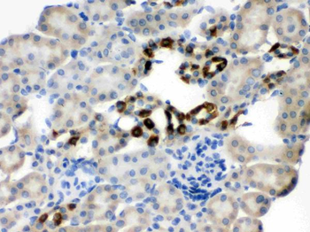 PGRMC1 Rabbit Polyclonal Antibody