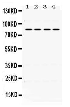 PI 3 Kinase p85 beta/PIK3R2 Rabbit Polyclonal Antibody
