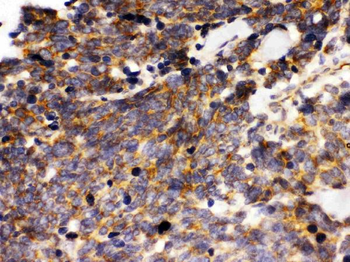 LAR/PTPRF Rabbit Polyclonal Antibody