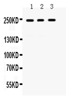LAR/PTPRF Rabbit Polyclonal Antibody