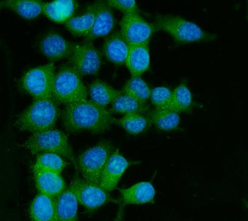 RAB13 Rabbit Polyclonal Antibody