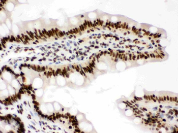 RbAp48/RBBP4 Rabbit Polyclonal Antibody