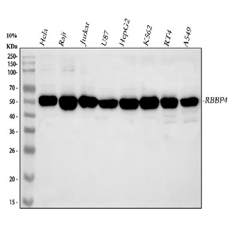 RbAp48/RBBP4 Rabbit Polyclonal Antibody