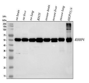 RbAp48/RBBP4 Rabbit Polyclonal Antibody