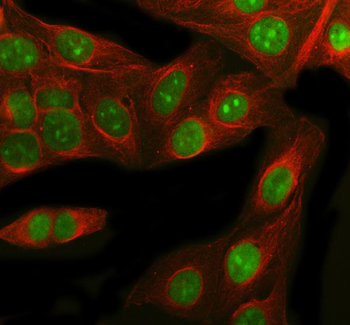 RbAp48/RBBP4 Rabbit Polyclonal Antibody