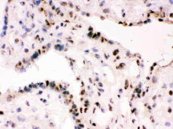 RbAp48/RBBP4 Rabbit Polyclonal Antibody