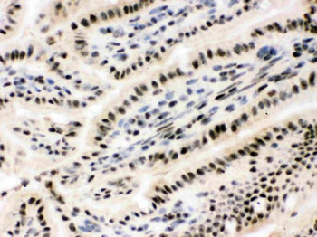 RbAp48/RBBP4 Rabbit Polyclonal Antibody