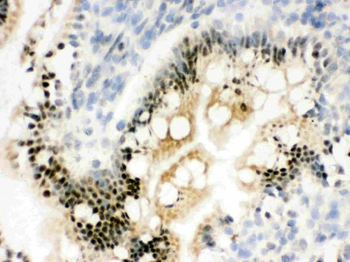 RbAp48/RBBP4 Rabbit Polyclonal Antibody