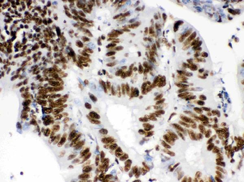 RbAp48/RBBP4 Rabbit Polyclonal Antibody