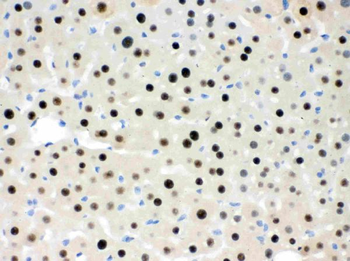 RbAp48/RBBP4 Rabbit Polyclonal Antibody