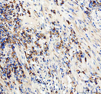 CD19 Rabbit Polyclonal Antibody