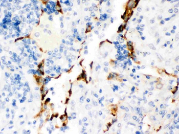 Kv1.4/KCNA4 Rabbit Polyclonal Antibody