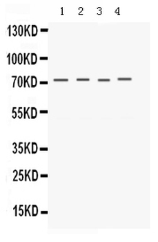 Kv1.4/KCNA4 Rabbit Polyclonal Antibody