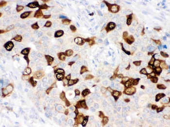 RRM2 Rabbit Polyclonal Antibody