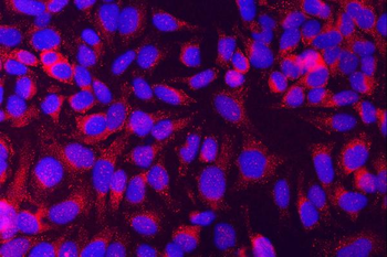 Munc18-1/STXBP1 Rabbit Polyclonal Antibody