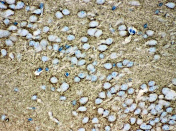 Munc18-1/STXBP1 Rabbit Polyclonal Antibody