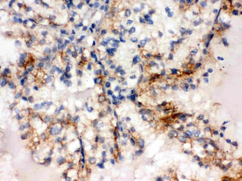 SULT2A1 Rabbit Polyclonal Antibody