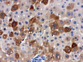 SULT2A1 Rabbit Polyclonal Antibody