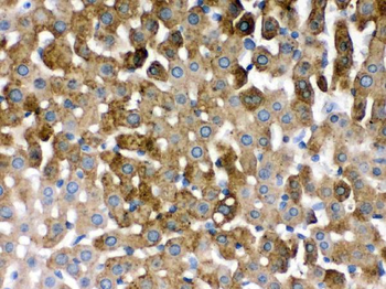SULT2A1 Rabbit Polyclonal Antibody