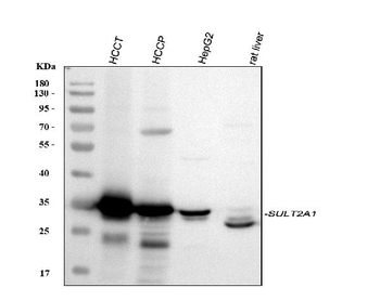 SULT2A1 Rabbit Polyclonal Antibody