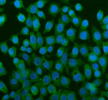 TCP1 alpha Rabbit Polyclonal Antibody