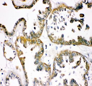 TCP1 alpha Rabbit Polyclonal Antibody