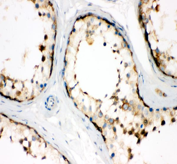 TCP1 alpha Rabbit Polyclonal Antibody
