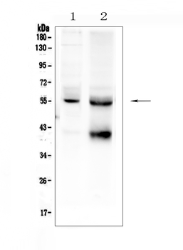 TGF beta Receptor I/TGFBR1 Rabbit Polyclonal Antibody