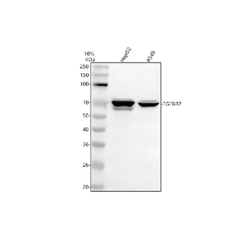 TGF beta Receptor II/TGFBR2 Rabbit Polyclonal Antibody