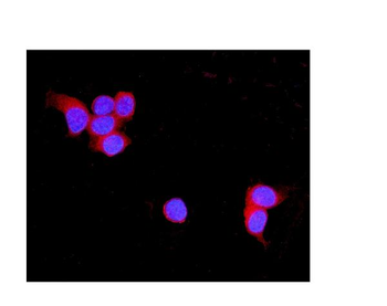 TNXB Rabbit Polyclonal Antibody