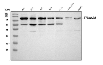 KAP1/TRIM28 Rabbit Polyclonal Antibody