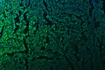 KAP1/TRIM28 Rabbit Polyclonal Antibody