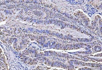 KAP1/TRIM28 Rabbit Polyclonal Antibody