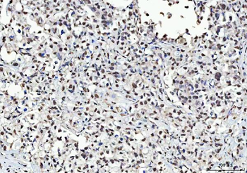 KAP1/TRIM28 Rabbit Polyclonal Antibody