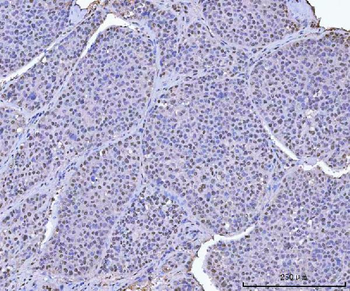 KAP1/TRIM28 Rabbit Polyclonal Antibody