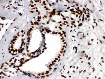 KAP1/TRIM28 Rabbit Polyclonal Antibody