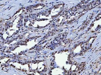 KAP1/TRIM28 Rabbit Polyclonal Antibody