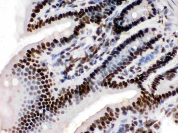 KAP1/TRIM28 Rabbit Polyclonal Antibody