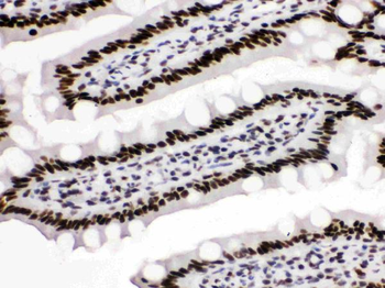 KAP1/TRIM28 Rabbit Polyclonal Antibody