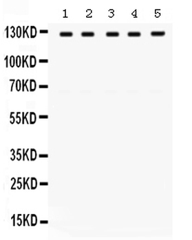 TRPM8 Rabbit Polyclonal Antibody