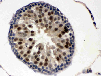 UBE1C/UBA3 Rabbit Polyclonal Antibody