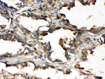 UBE2Q2 Rabbit Polyclonal Antibody