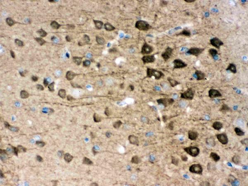 PGP9.5/UCHL1/PGP9 Rabbit Polyclonal Antibody