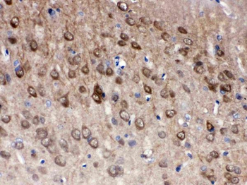 PGP9.5/UCHL1/PGP9 Rabbit Polyclonal Antibody